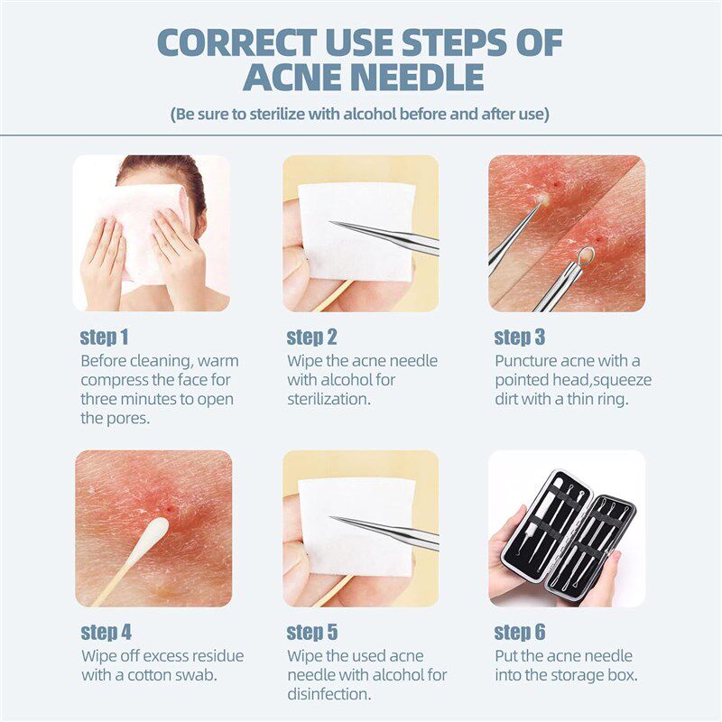 Blackhead Remover Tool Blemish Whitehead Popping Zit图片