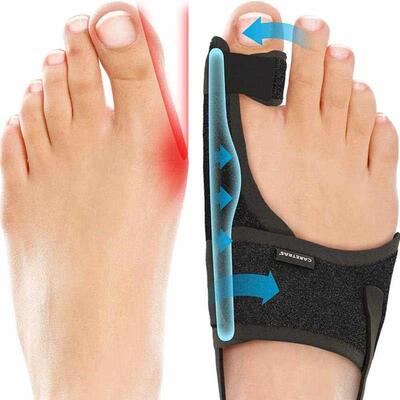 Orthopedic Bunion Splint Corrector Big Toe Separator Pain Re