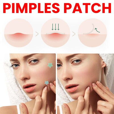 Acne patch to lighten acne spots and repair skin 痘痘贴 淡化