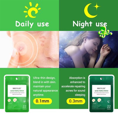 Acne Pimple Patch  Stickers Acne Treatment Pimple Remover To