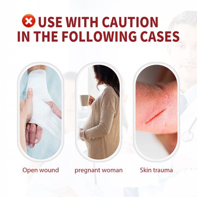 Varicose Veins Relief Cream Leg Vasculitis Phlebitis Spider