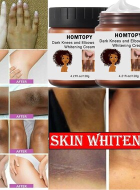 Dark Knees and Elbows Strong Whitening Cream