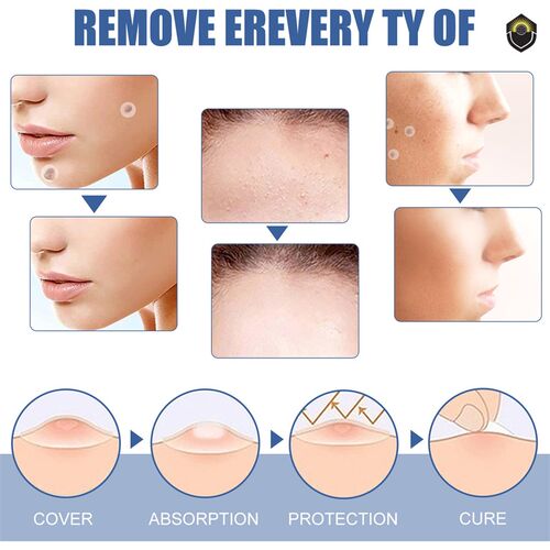 144Pcs Skin Tag Remover Patches Mole Wart Removing Sticker N