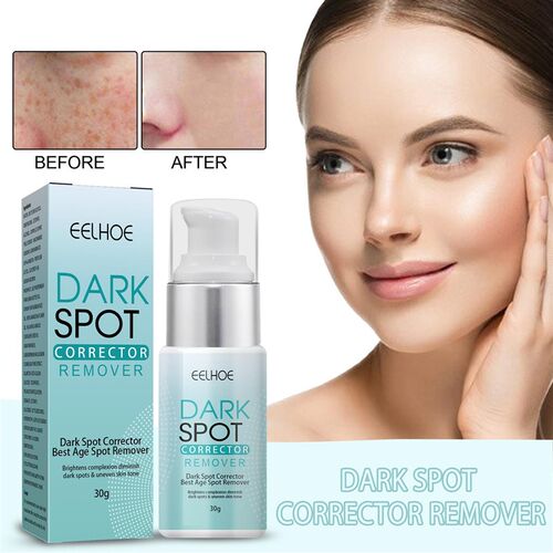 30g Dark Spot Remover Corrector Age Spot Freckle Removal Emu