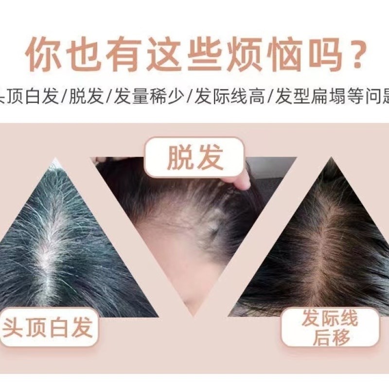 补发片女头顶头发稀少遮盖真发蓬松发顶隐形发块遮白发卷发假发片
