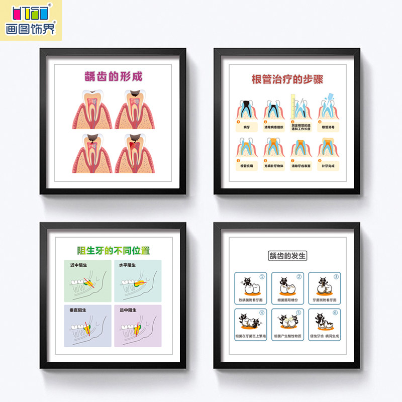 牙科挂图口腔解剖知识装饰画照片墙医院沙发种植海报健康结构-15,家居饰品,现代装饰画,淘宝优惠券,粉丝福利购,淘宝优惠卷