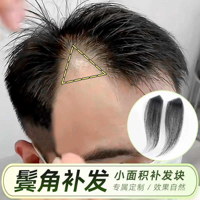 男女通用真人发鬓角补发片假发片男士假刘海发一片式发际线假发贴