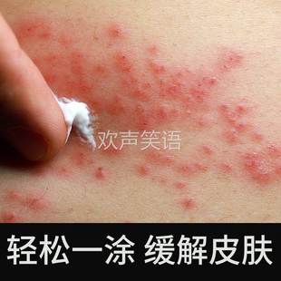 苗家祖方抑菌膏正品苗三叔苗家祖方草本软膏爷爷的老方子外用乳膏