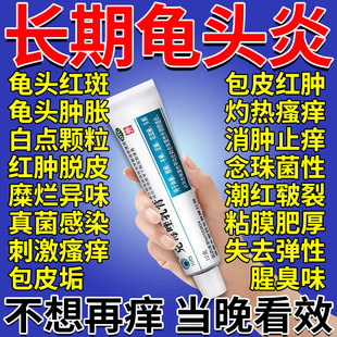 克霉唑乳膏正品龟头炎症专用药膏治疗男性私处瘙痒真菌感染包皮炎