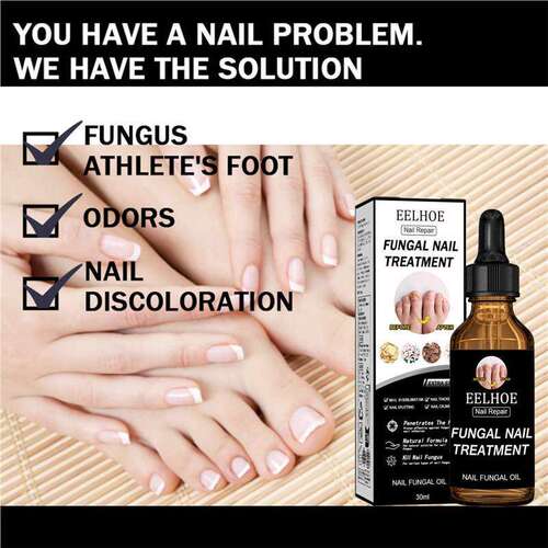 30ml Fungal Nail Repair Essence Feet CareTreatment Foot Toe