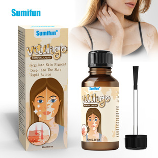 sumifun亚马逊跨境白斑护理液体均匀白斑肌肤外用护理液 k60018