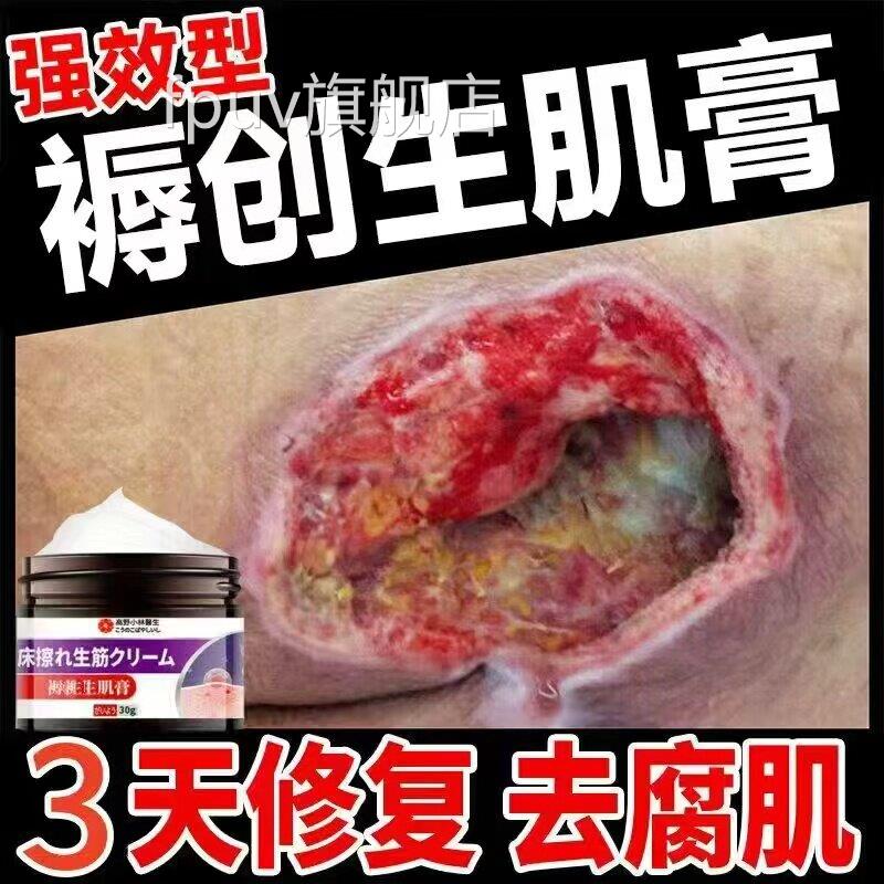 日本肉生肌去腐膏伤口愈合促进长膏专用卧床老人臀部屁屁外用空洞
