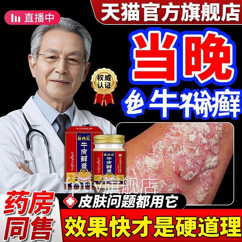 癣药膏真菌感染外用皮肤牛皮抑菌屑乳膏头皮股银皮肤杀菌止痒正品
