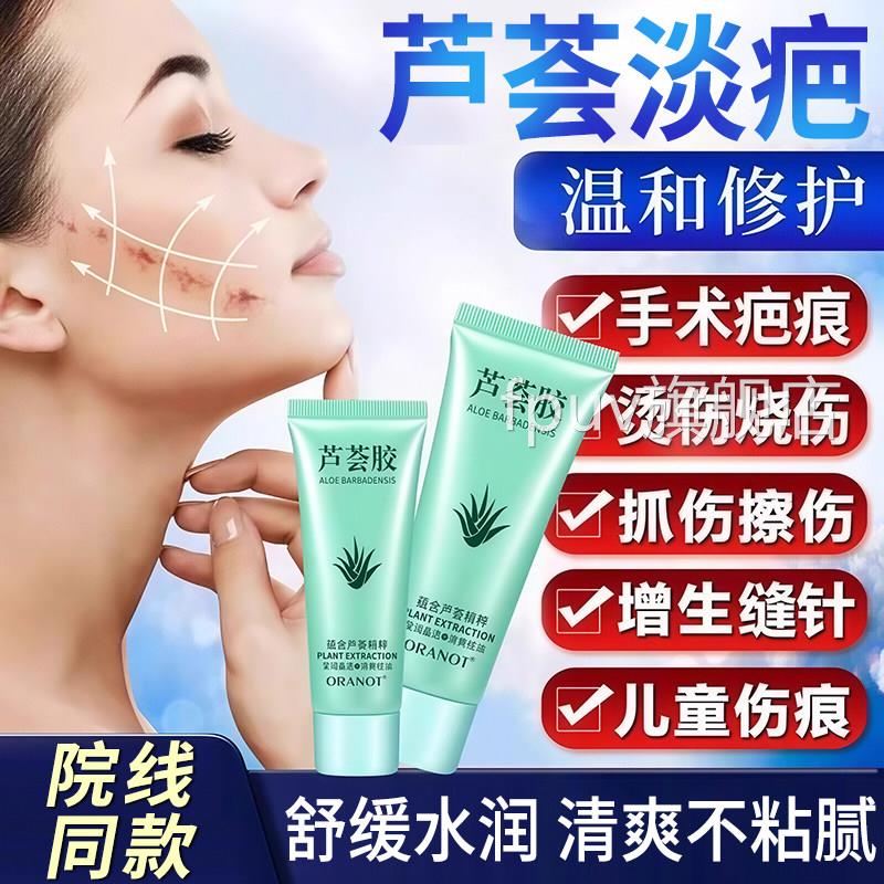 胶芦荟官方旗舰店正品祛痘印修护淡化医用型去疤痕止痒痘痘正品FP