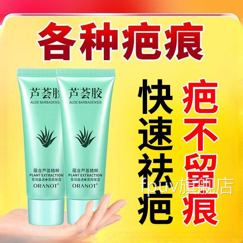 芦荟胶去疤痕去疤膏修复无痕祛疤贴除疤用可痕疤愈横完FPUV旗舰店