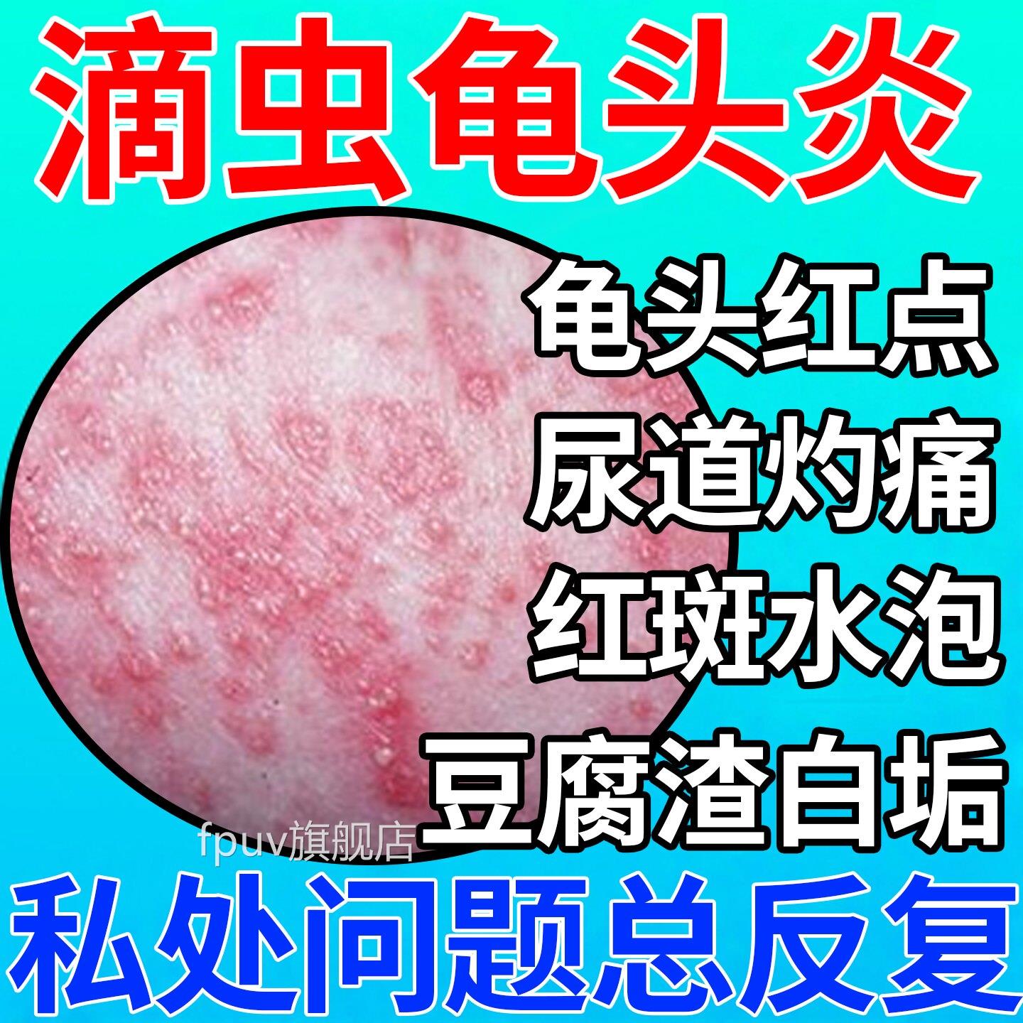 滴虫性龟头炎症龟头小红点尿道灼疼皮痛红斑水泡包下面豆腐渣白垢