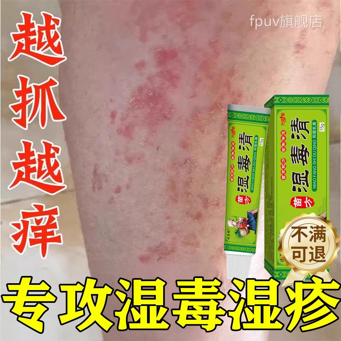 湿毒清软膏湿祛根湿痒热止痒皮肤炎瘙痒皮水泡治除湿专用膏FPUV旗