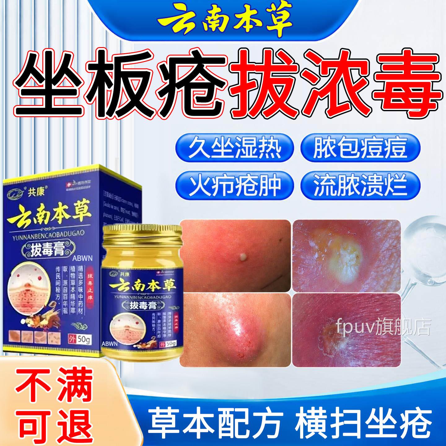 屁股上长痘痒痘痒起热疙瘩久坐板疮久坐湿热疖肿特止拔毒效药膏疼