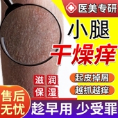 冬天腿痒小腿皮肤干燥瘙痒止痒起皮屑身体乳干性湿疹沐浴露QF