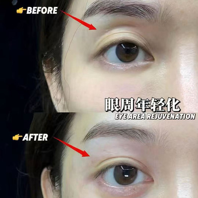 文殊愿力 眼周年轻化之用胶原蛋白精华改善眼窝 需送货上门