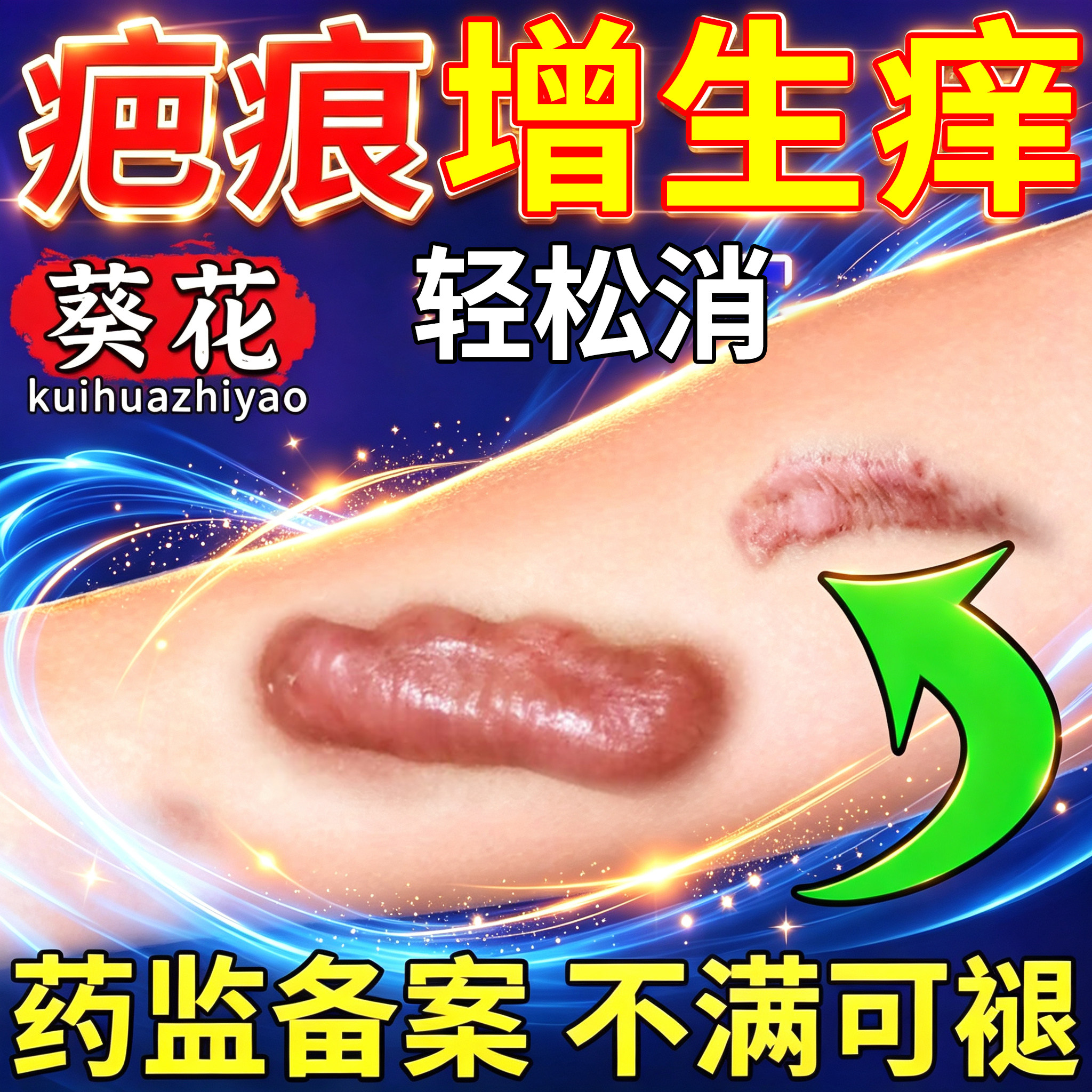 疤痕增生凸起去除疙瘩