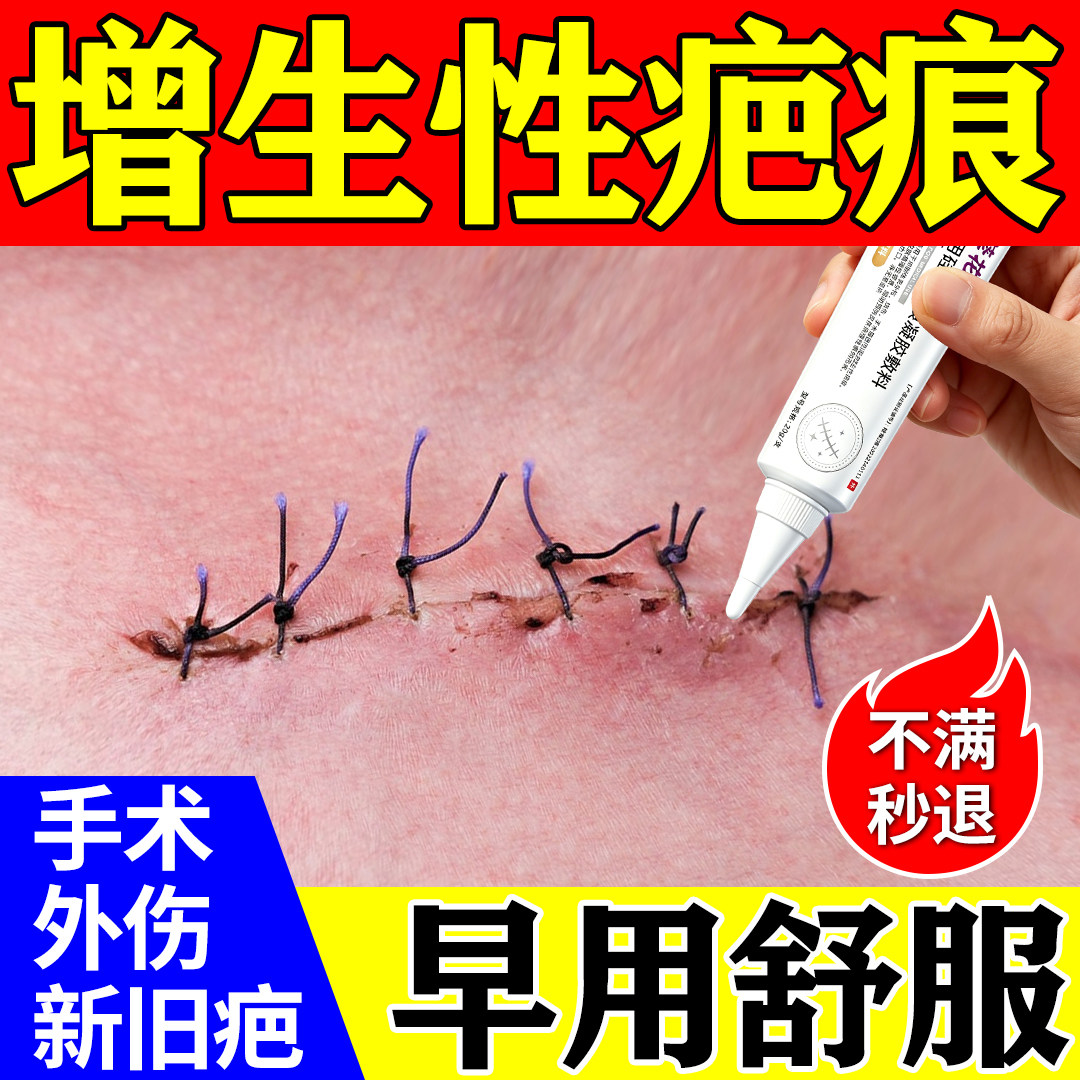 医用祛疤膏去除疤痕修复无痕祛疤硅酮凝胶剖腹产增生凸起疙瘩神器
