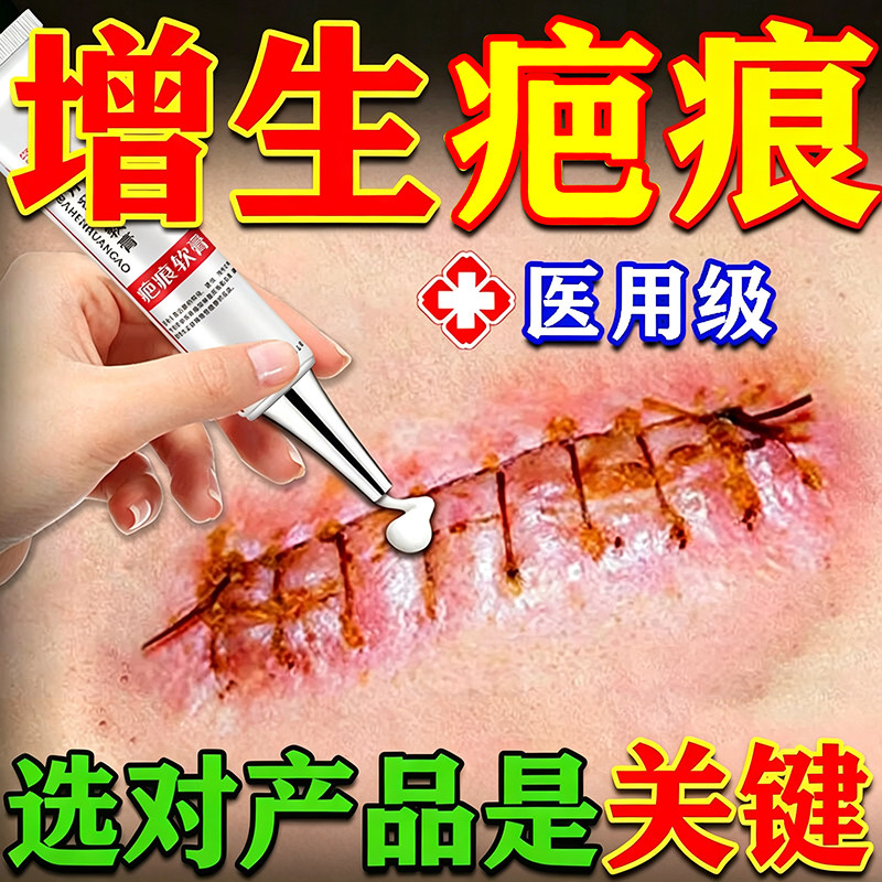 医用祛疤膏去除疤痕增生凸起疙瘩第一名剖腹产疤痕修复膏无痕祛疤