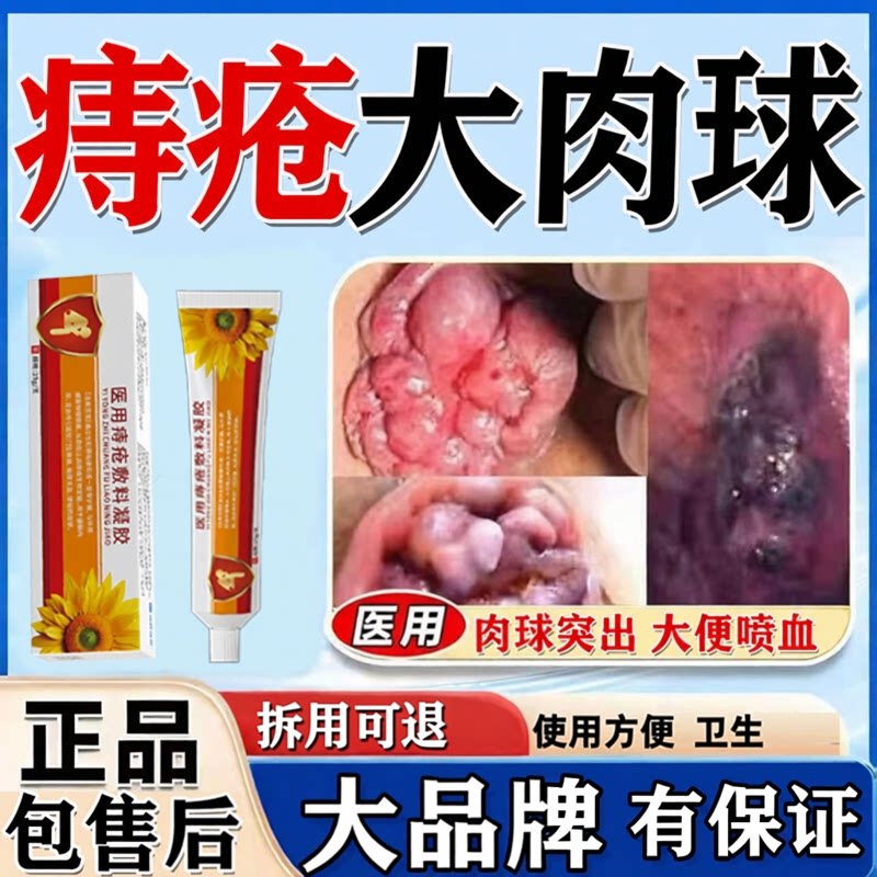 痔疮膏消肉球痔根男女性医用