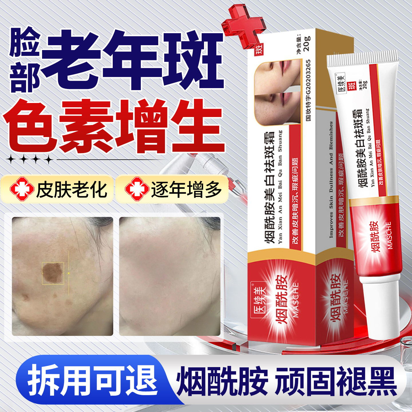 脸部老年斑祛黄褐斑烟酰胺美白祛斑霜雀斑专用强手部力去除男士SE