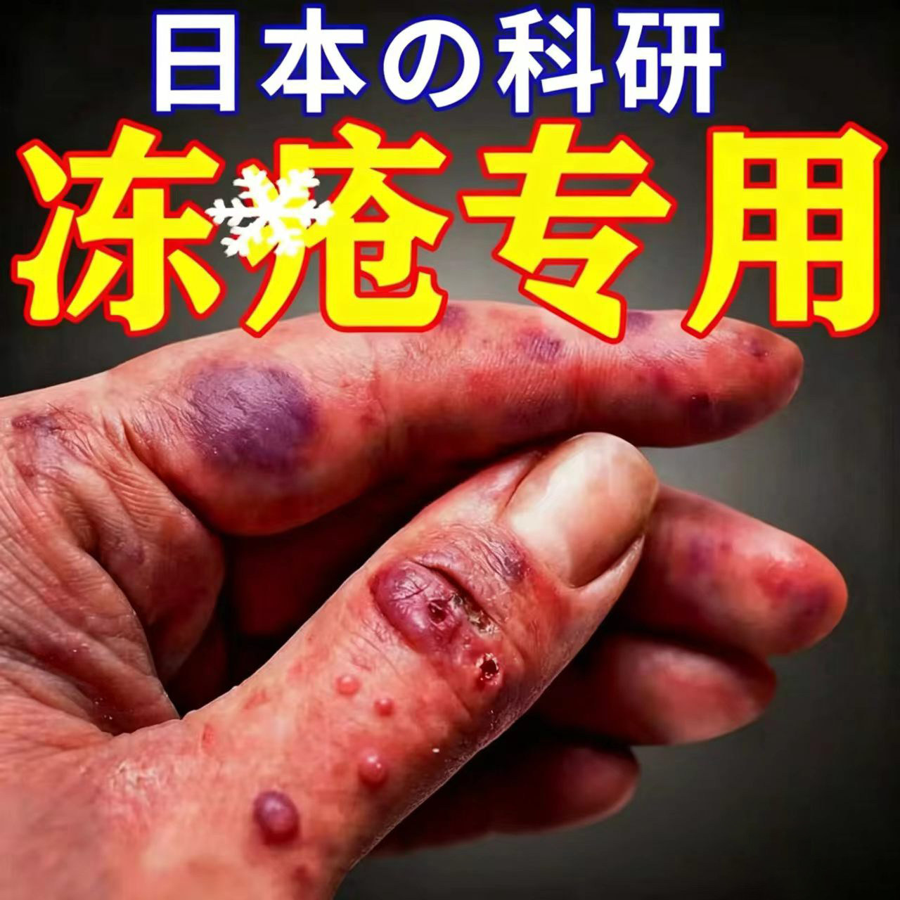 日本冻疮膏冻伤止痒膏防冻裂耳朵皮肤消毒护理（消）