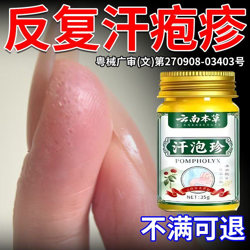 手上起小水泡汗泡疹止痒抑菌鹅掌风真菌感染疹脱皮止痒专用软膏