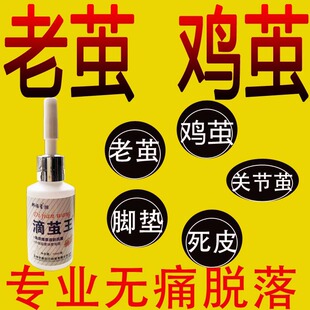 滴茧王清脚掌底老茧鸡茧子去除脚垫消手脚关节茧胼胝死皮软化神器