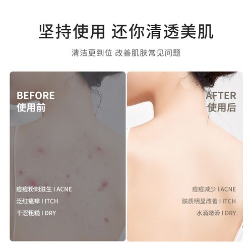 洗脚神器浴室刷脚去死皮卫生间擦背洗澡搓背按摩地垫防滑垫磨挫脚