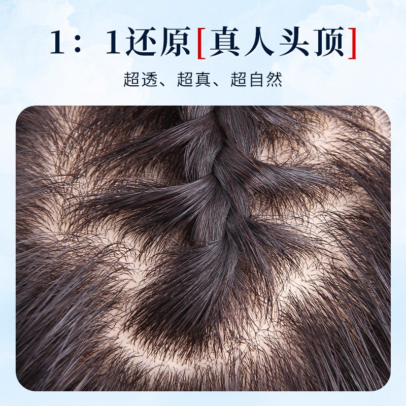 假发女片头顶增发量蓬松真发遮头顶白发高颅顶神器无痕刘海补发片