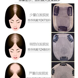 头顶补发片女遮白发轻薄无痕增发神器真发发盖卷发块中老年假发片