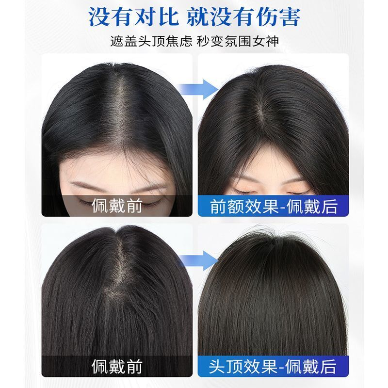 全真发头顶补发片女真人发丝遮白发假发片女长发一片式无痕补发块