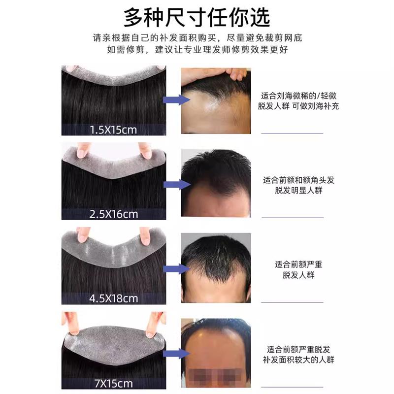 假发片男士前额假刘海真发刘海全真人发丝m型发际线贴假发贴自然