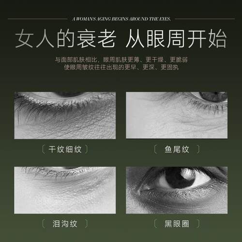 美眼仪眼部按摩仪提拉紧致眼袋去除仪器消肿抗衰黑眼圈眼部美容仪