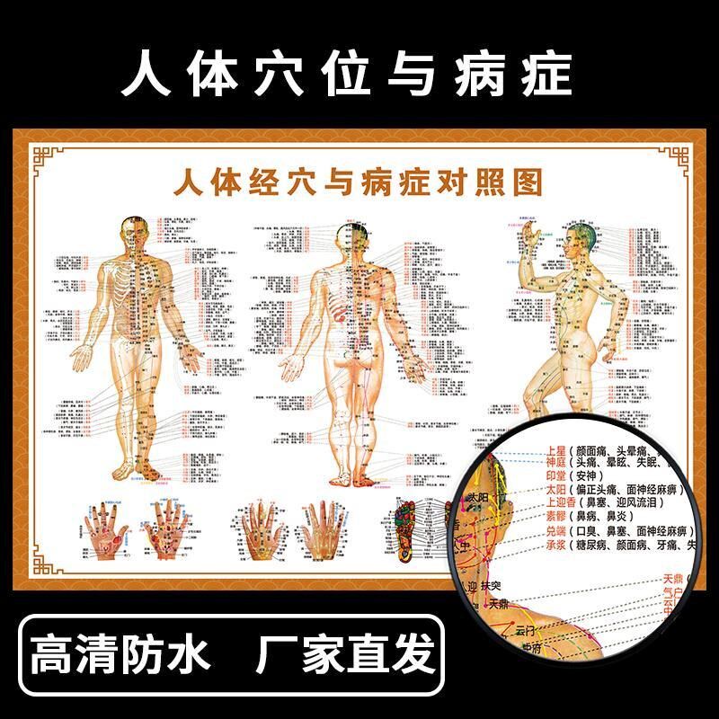 人体经穴病症图墙贴纸海报男性人现代装饰画