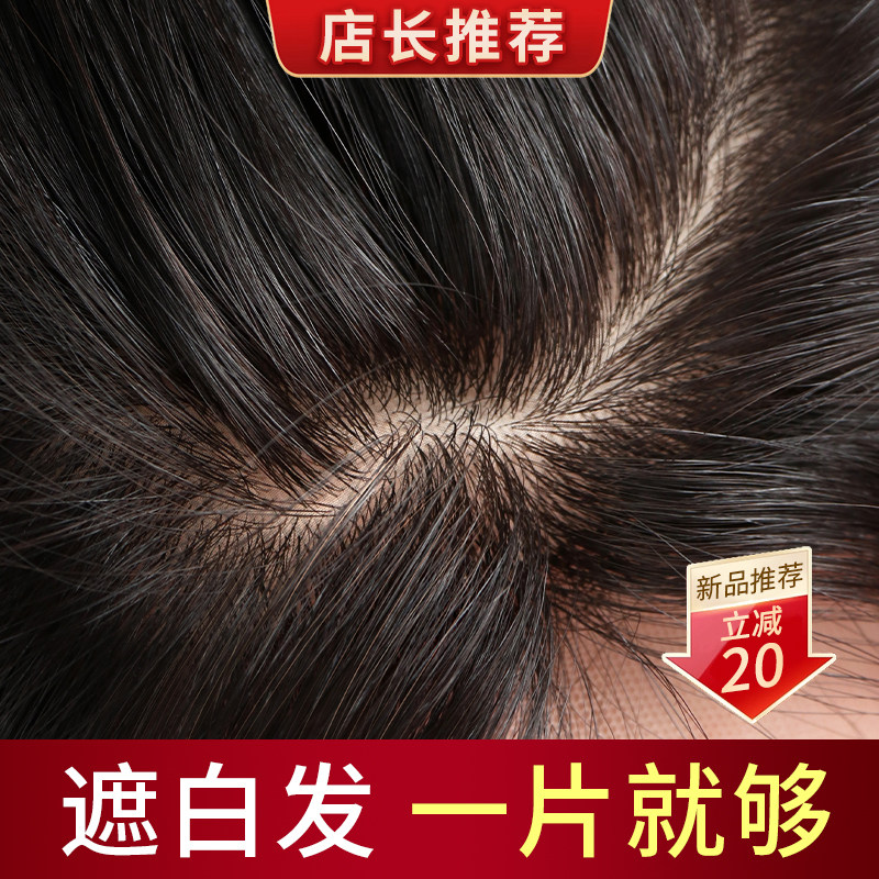 双递针假发片女头顶全真人发自然前额高颅顶无痕遮白发刘海补发片