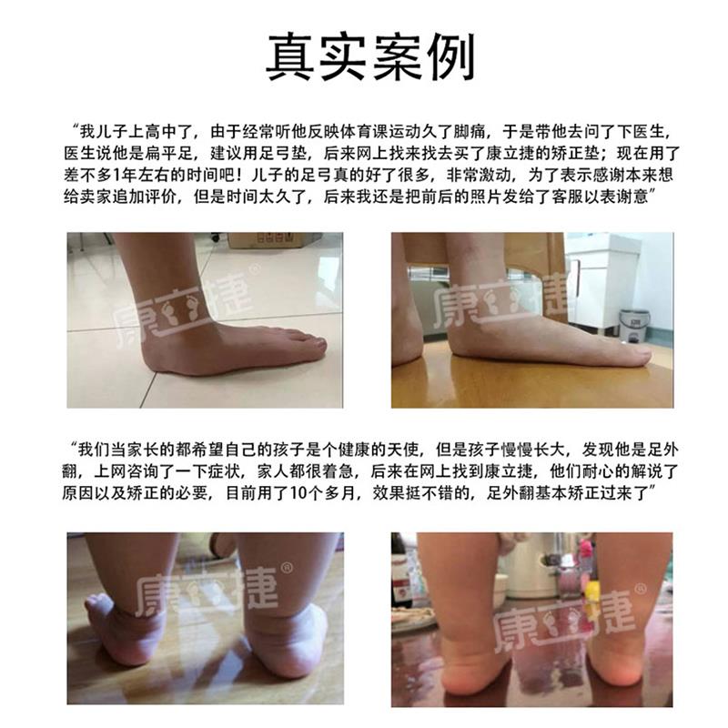 定制矫正鞋垫扁平足弓支撑专用足外翻纠正内外八字足内翻XO型腿器