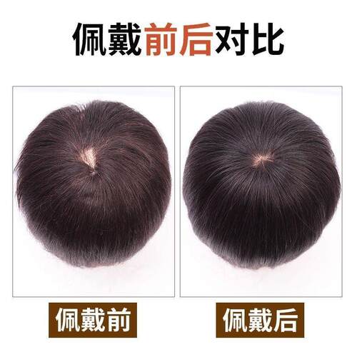 假发女短发头顶补发片遮白发自然无痕仿真发补发块假发片轻薄款