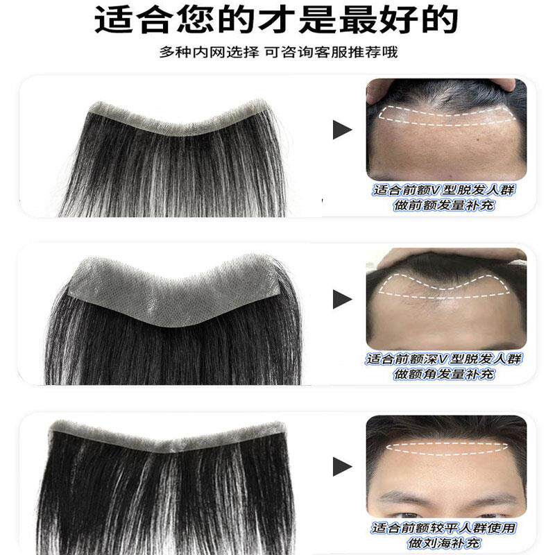 发际线假发贴m型男士刘海假发片无痕隐形短发全真发v型前额补发片