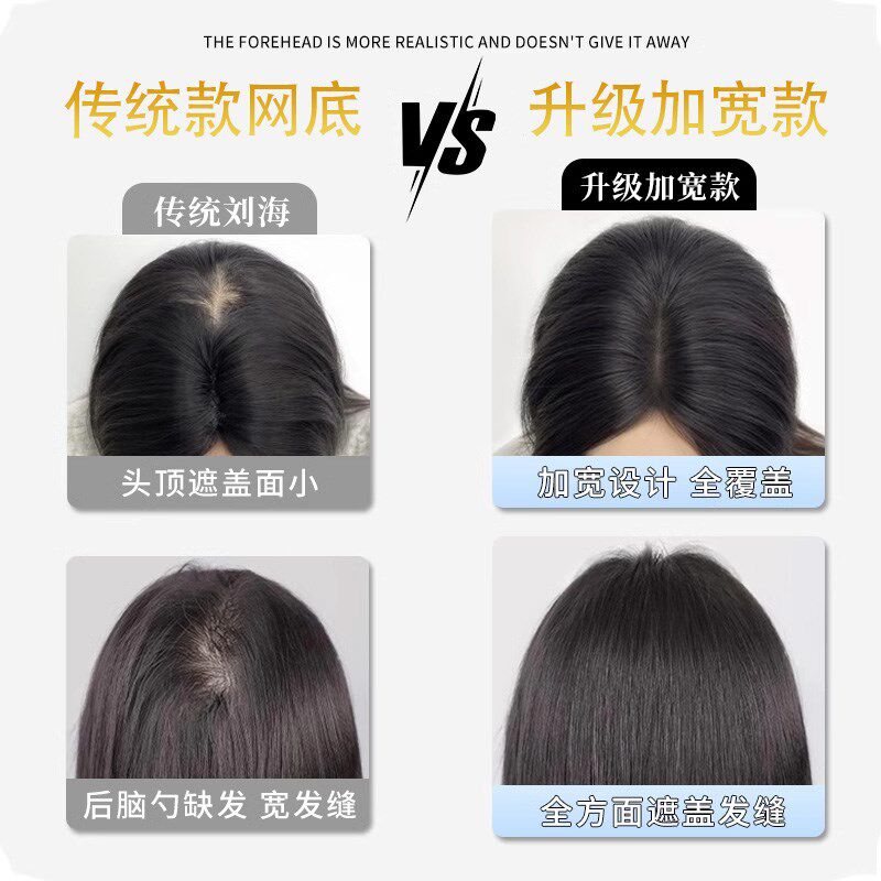 前额无边假发女片头顶补发真发蓬松增发量无痕隐形贴高颅顶假刘海
