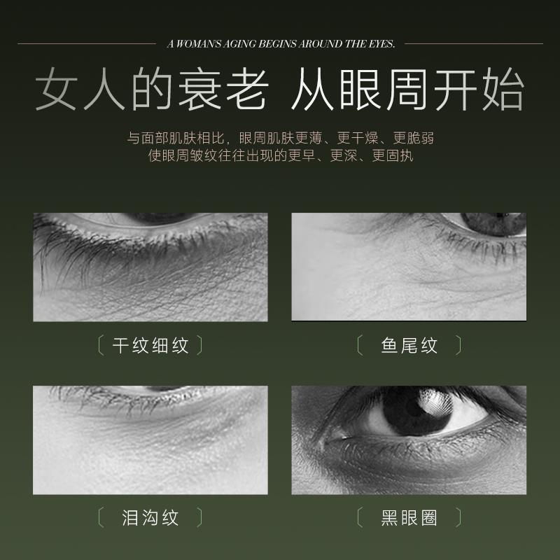 美眼仪眼部按摩仪提拉紧致眼袋去除仪器消肿抗衰黑眼圈眼部美容仪