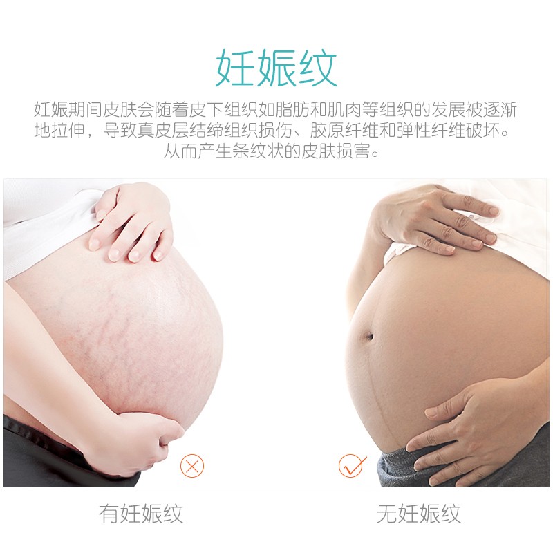 托腹带孕妇专用孕中期晚期孕妇托腹带孕晚期肚子腰托孕期怀孕腹带