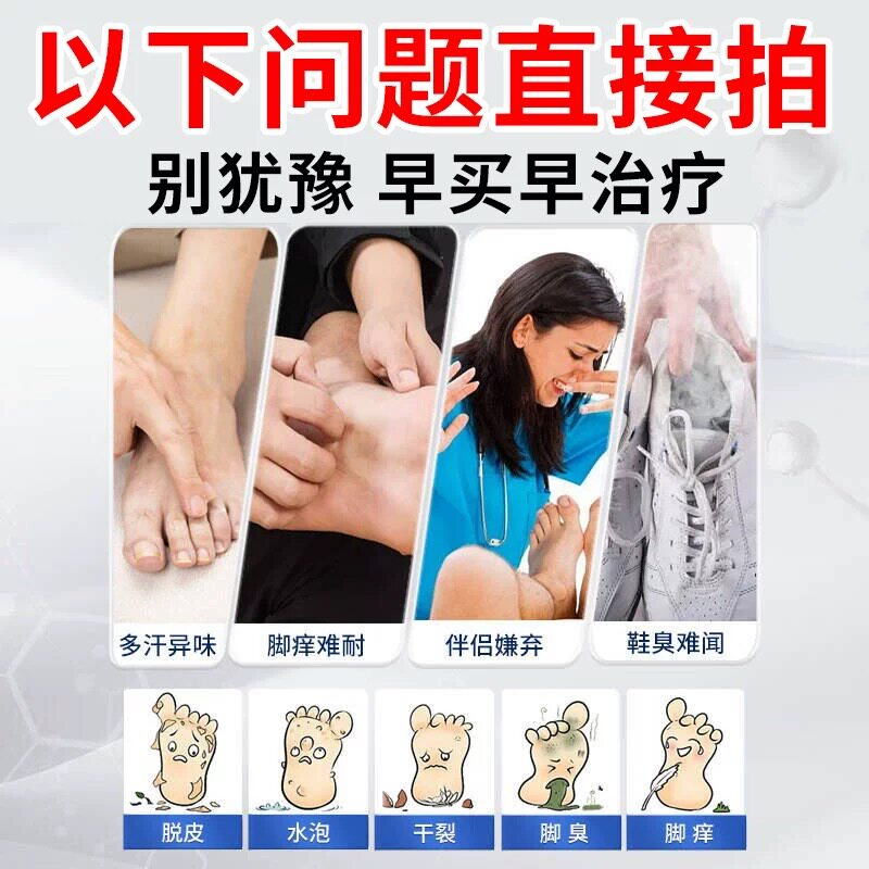 云南真菌王脚气止痒抑菌水泡脱皮烂脚丫脚臭脚裂脚汗脚痒裂脚气膏