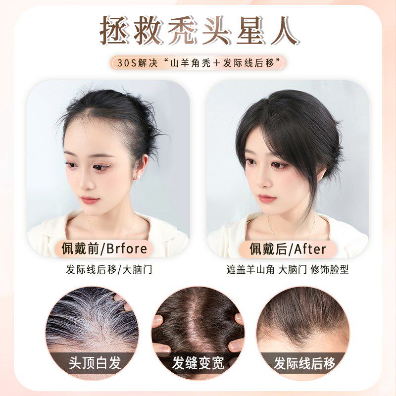 胎毛八字刘海假发女片头顶真发轻薄自然前额鬓角补发发际线假发贴