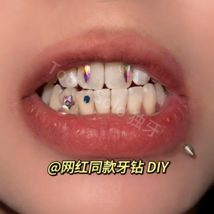 牙钻装饰爆闪牙钻自粘网红牙齿装饰水晶牙饰不伤牙持久diy套装