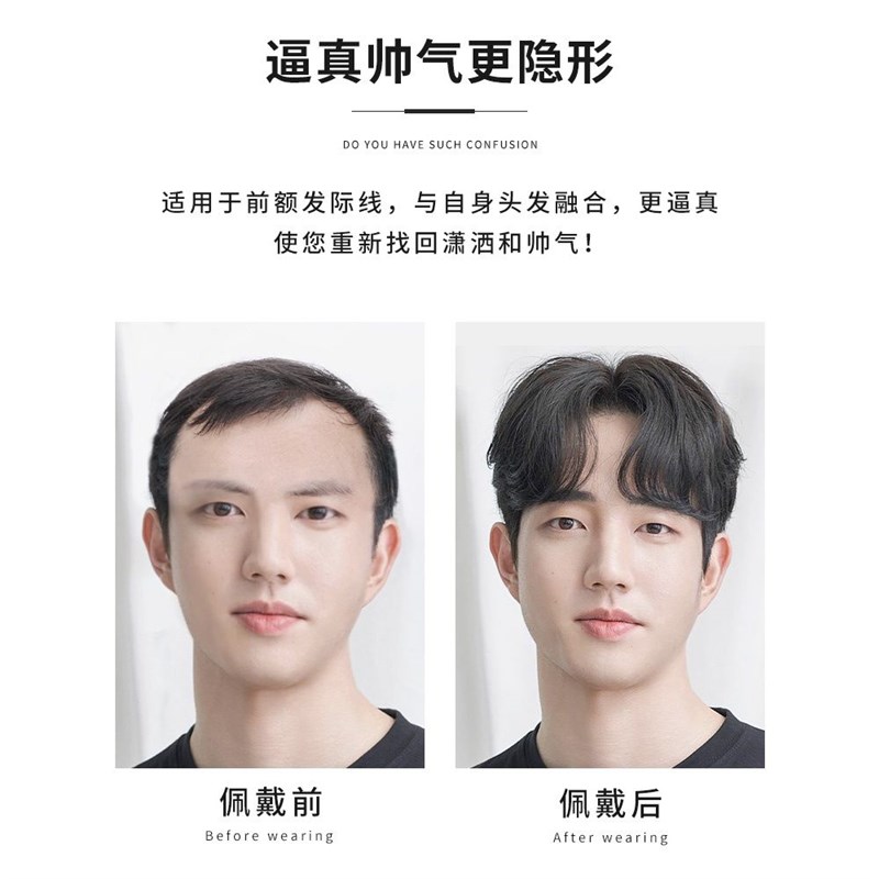 发际线假发贴男隐形无痕前额发际线假刘海生物头皮真发M型假发片